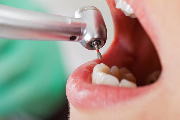 Best Emergency Dental Extractions in Graymoor Devondale, KY